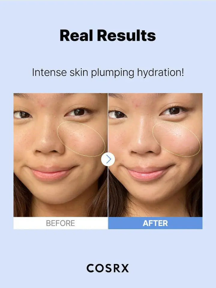 The Hyaluronic Acid 3 Serum - CORSX Cosmetics