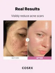 The Niacinamide 15 Serum - CORSX Cosmetics