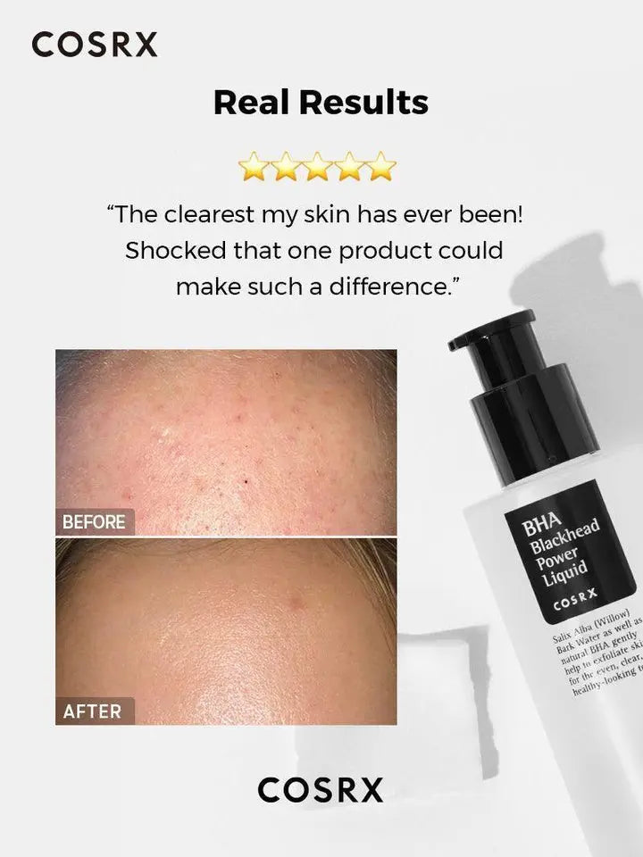 BHA Blackhead Power Liquid - CORSX Cosmetics