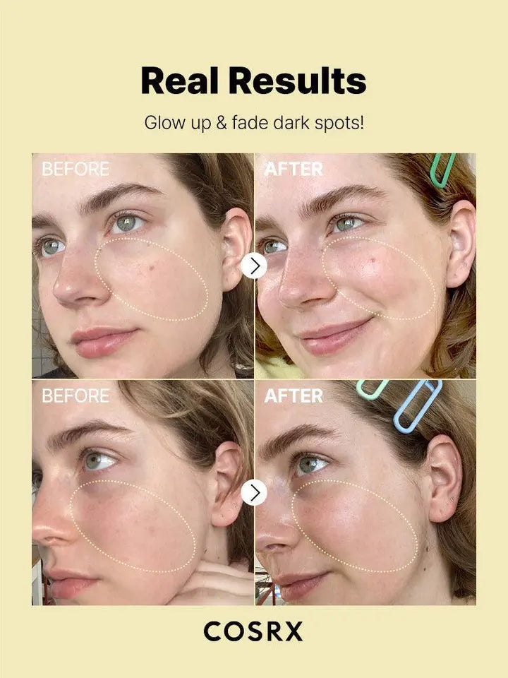 The Vitamin C 23 Serum - CORSX Cosmetics